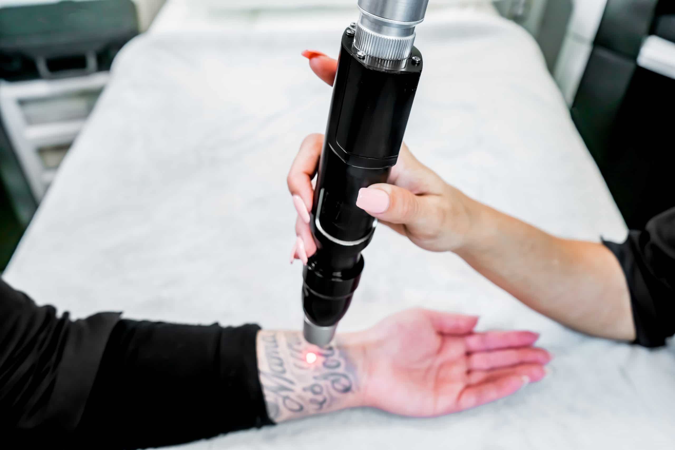 With The Pico Laser, Tattoo Removal Is Easier And More Comfortable